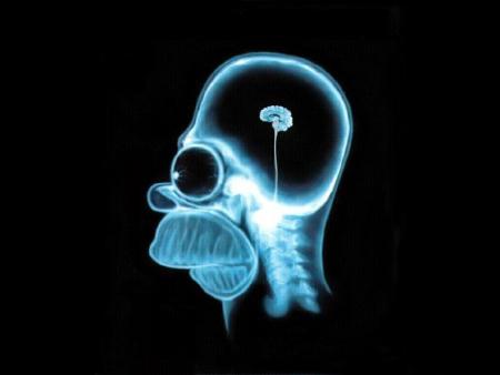 Cerveau de Bart  Simpson aux rayons X